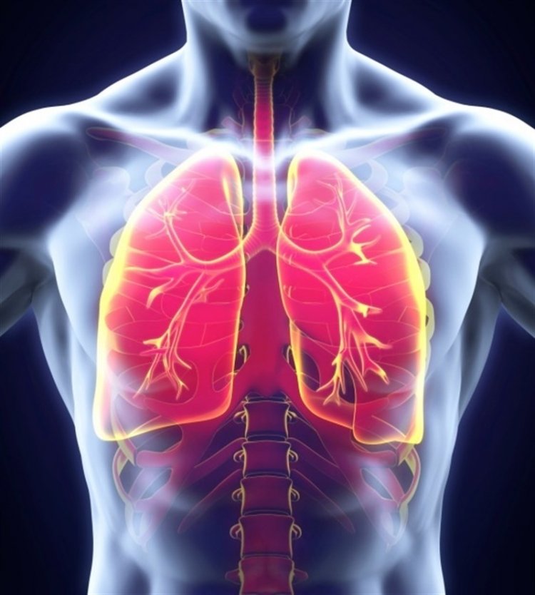 Todo lo que debe saber acerca de la tuberculosis   